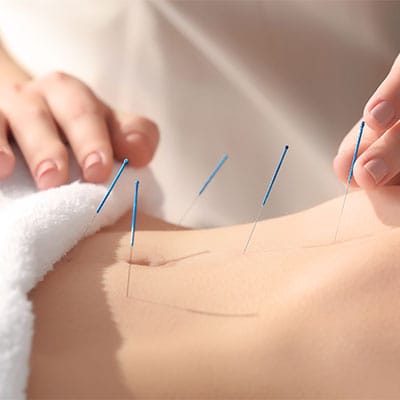 ACUPUNCTURE 